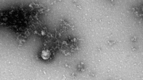 Российские учёные получили первое «фото» британского штамма коронавируса