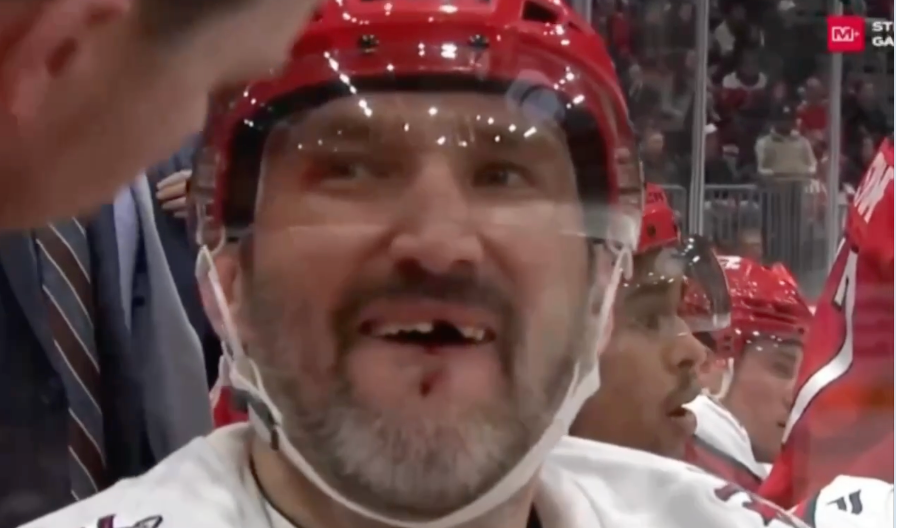 Овечкин потерял зуб после удара клюшкой в лицо в матче НХЛ