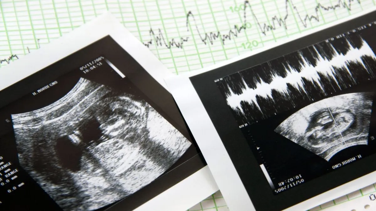 В России задумались о запрете абортов в частных клиниках
