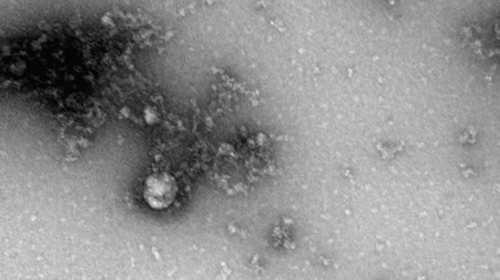 Российские учёные получили первое «фото» британского штамма коронавируса